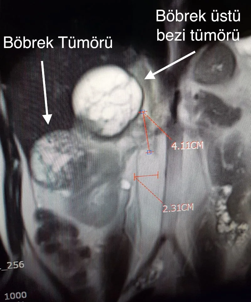 Önol Üroloji Önol Üroloji