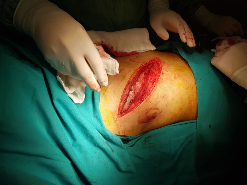 Önol Üroloji Önol Üroloji