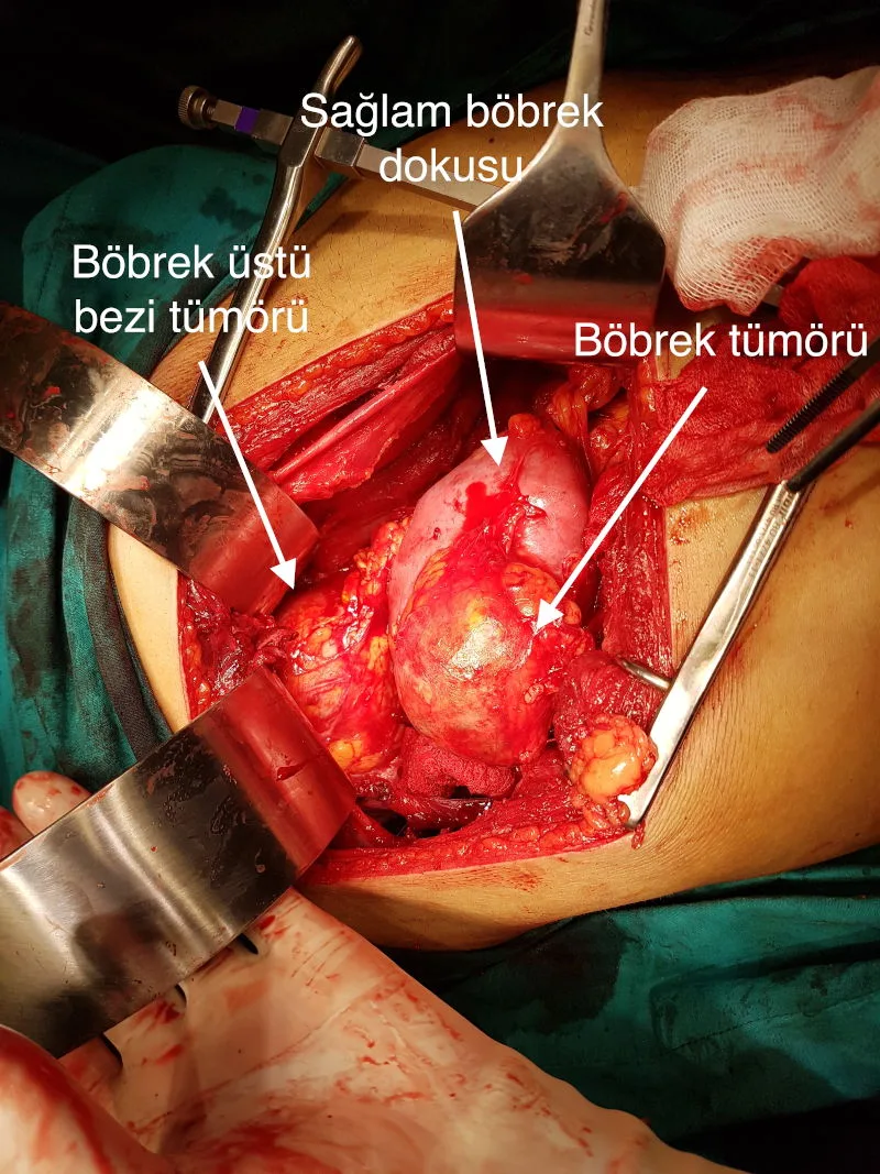 Önol Üroloji Önol Üroloji