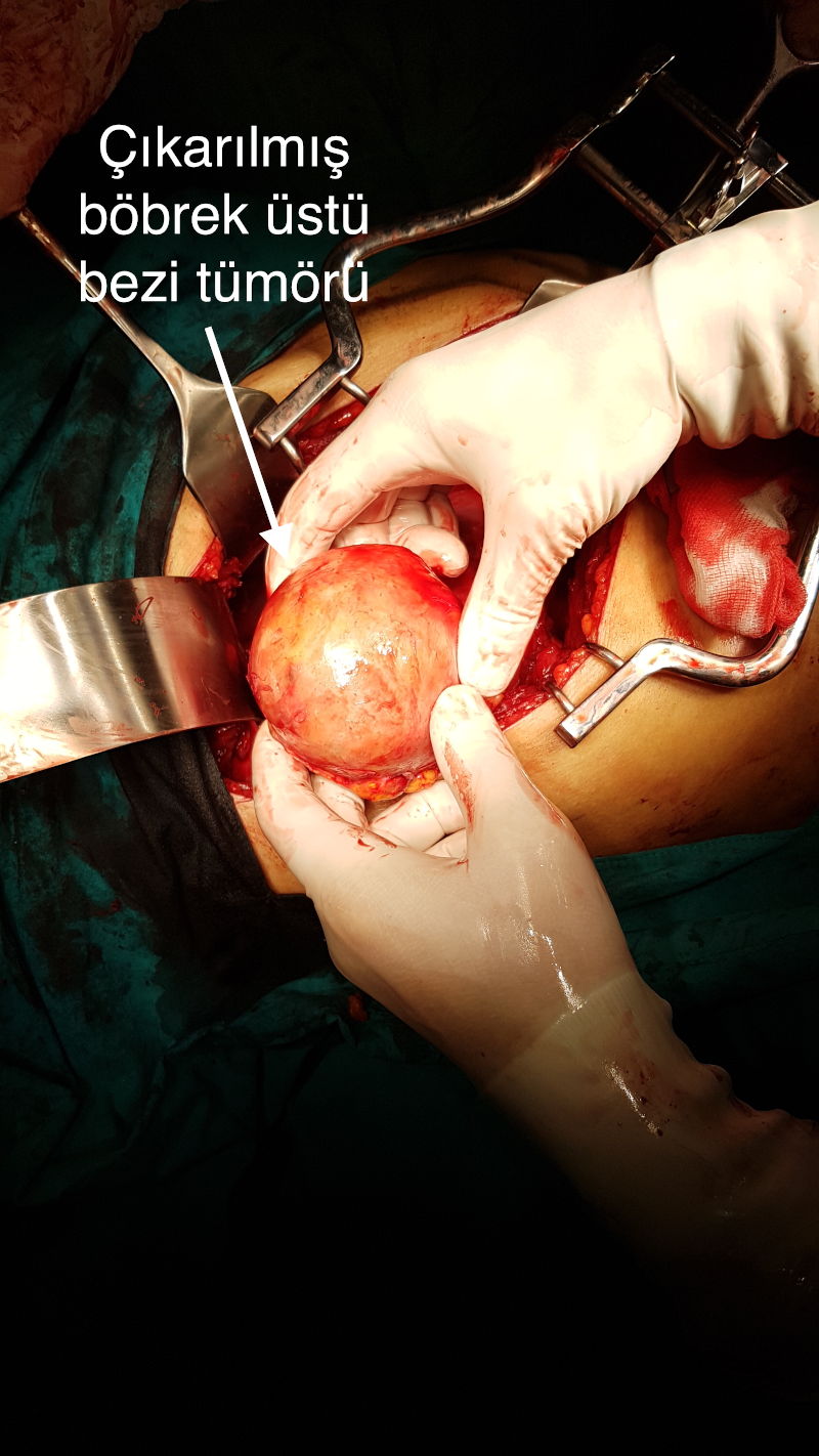 Önol Üroloji Önol Üroloji