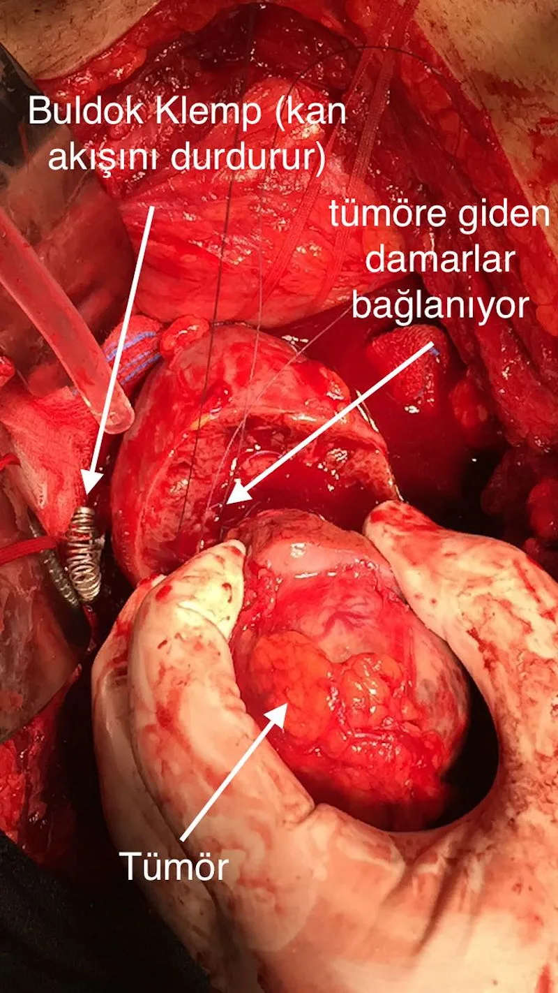 Önol Üroloji Önol Üroloji