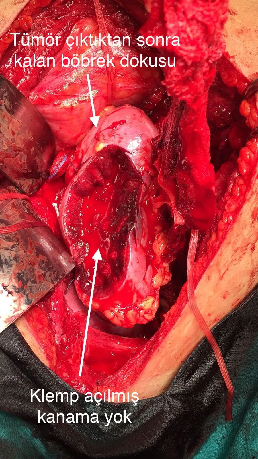 Önol Üroloji Önol Üroloji