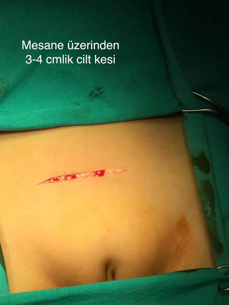 Önol Üroloji Önol Üroloji