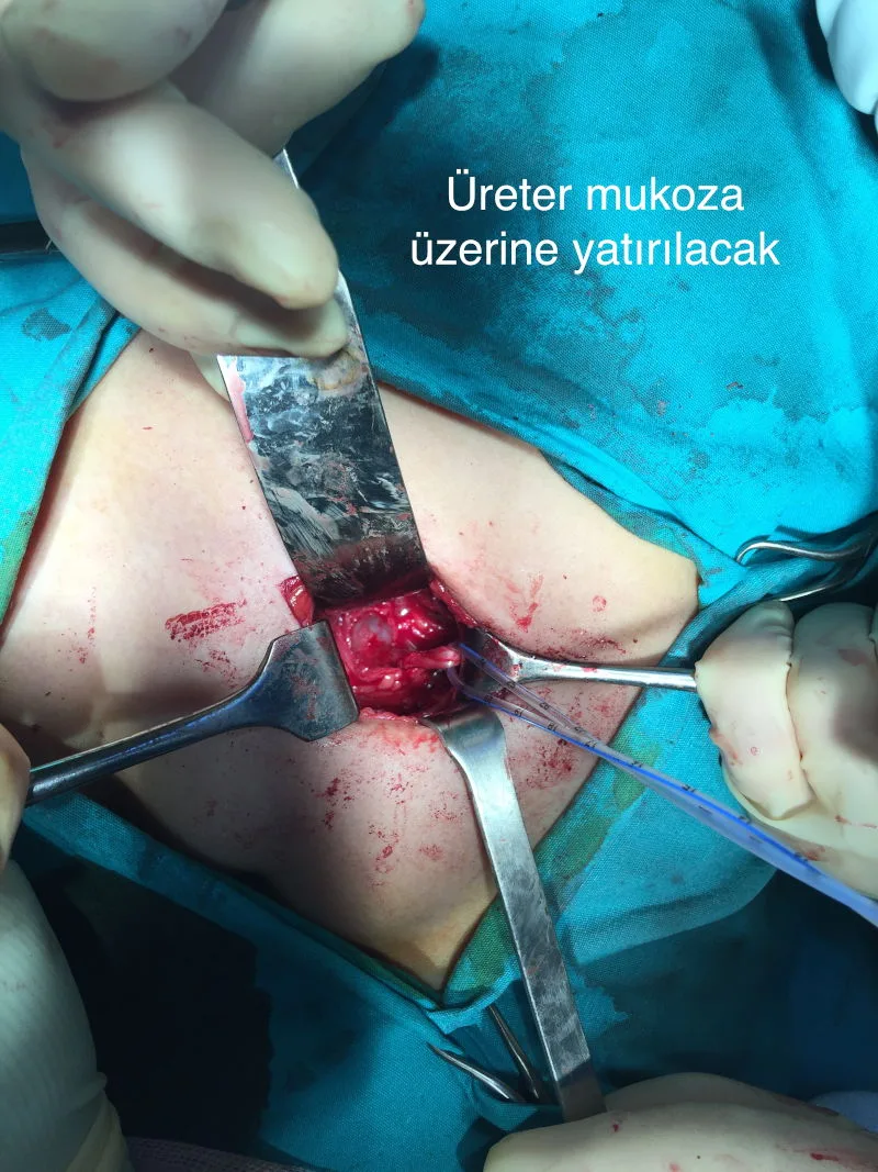 Önol Üroloji Önol Üroloji