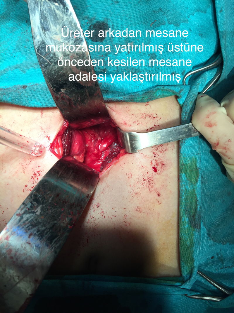 Önol Üroloji Önol Üroloji