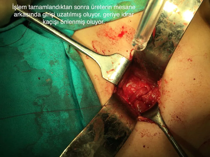 Önol Üroloji Önol Üroloji