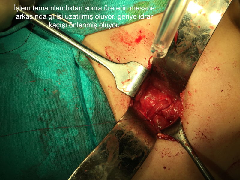 Önol Üroloji Önol Üroloji