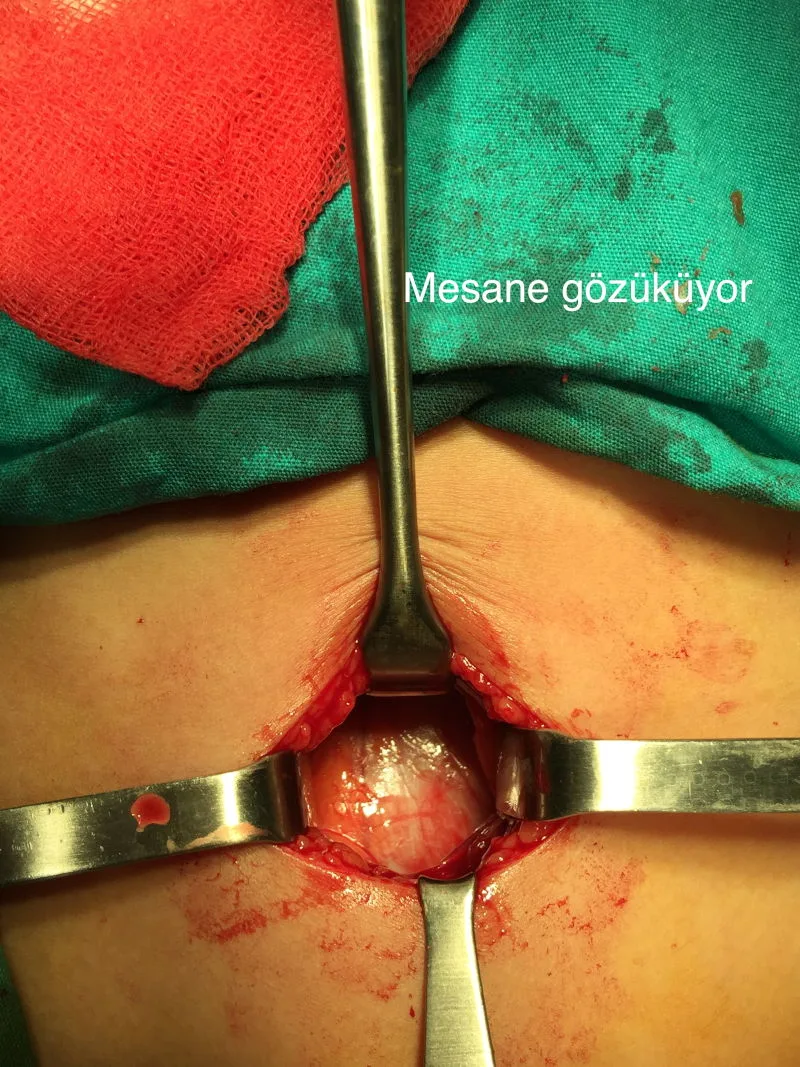 Önol Üroloji Önol Üroloji