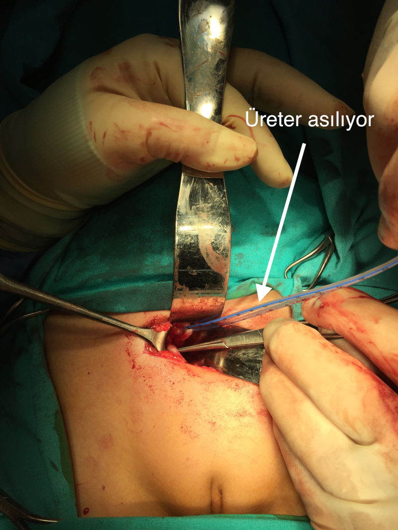 Önol Üroloji Önol Üroloji