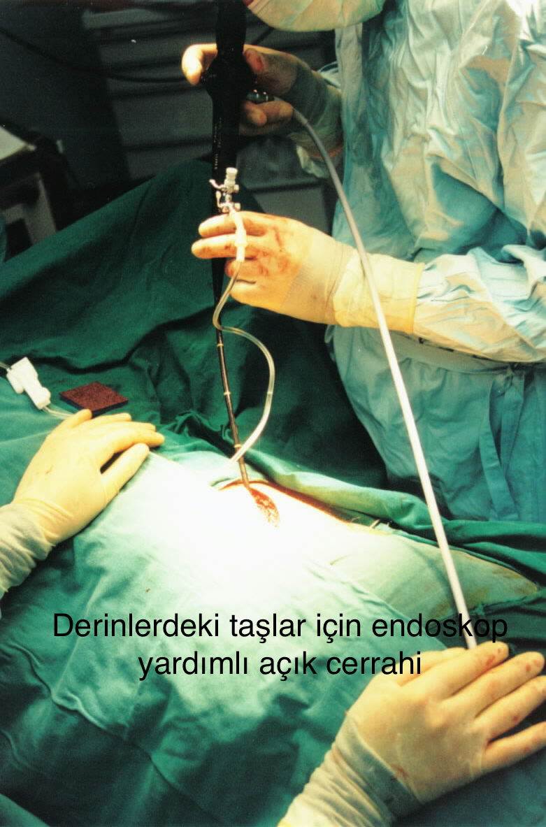 Önol Üroloji Önol Üroloji