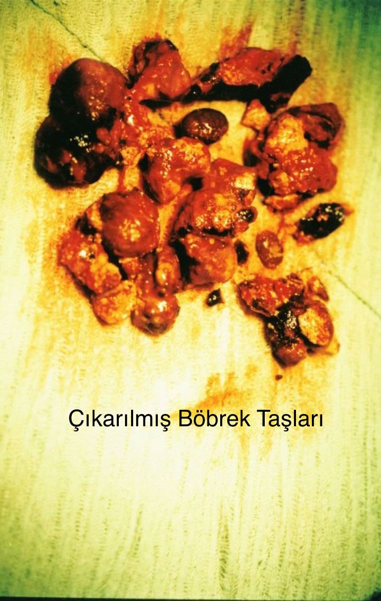 Önol Üroloji Önol Üroloji