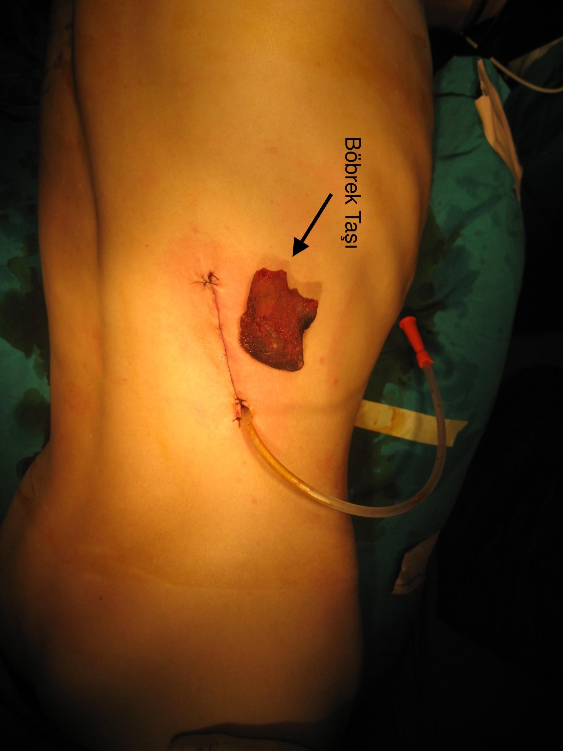 Önol Üroloji Önol Üroloji