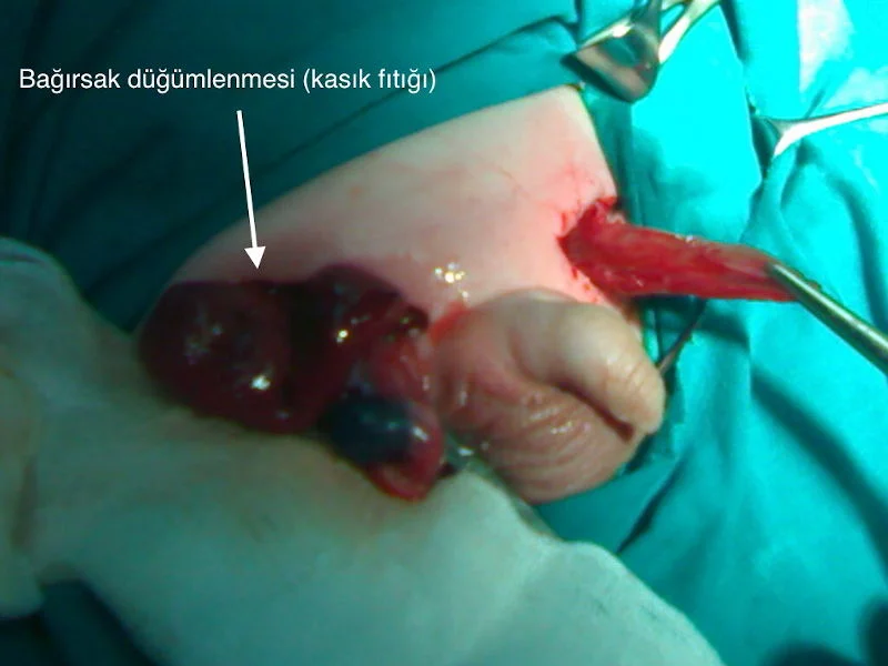 Önol Üroloji Önol Üroloji