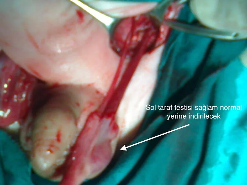 Önol Üroloji Önol Üroloji