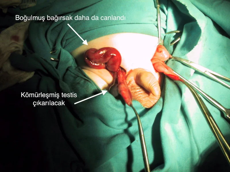 Önol Üroloji Önol Üroloji