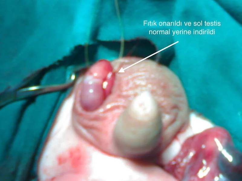 Önol Üroloji Önol Üroloji