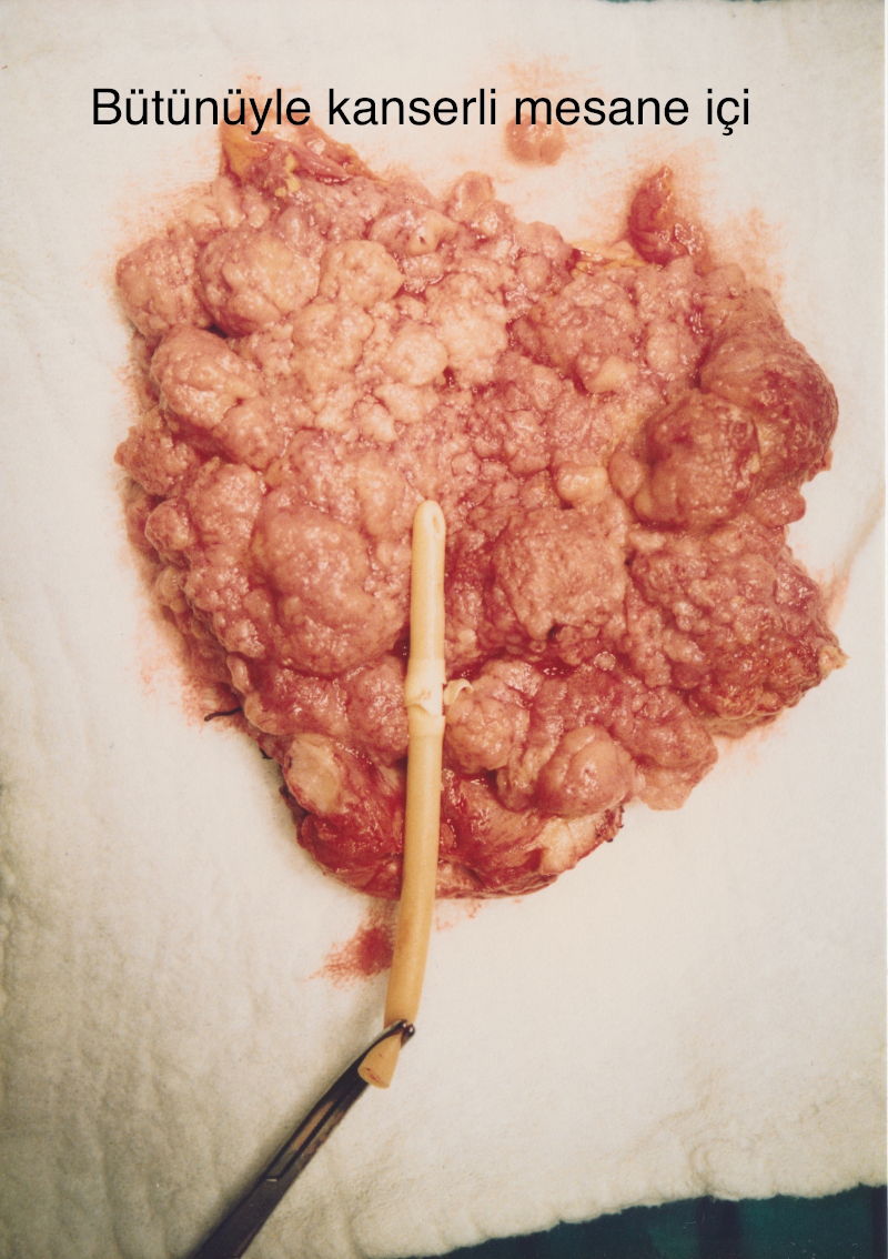 Önol Üroloji Önol Üroloji