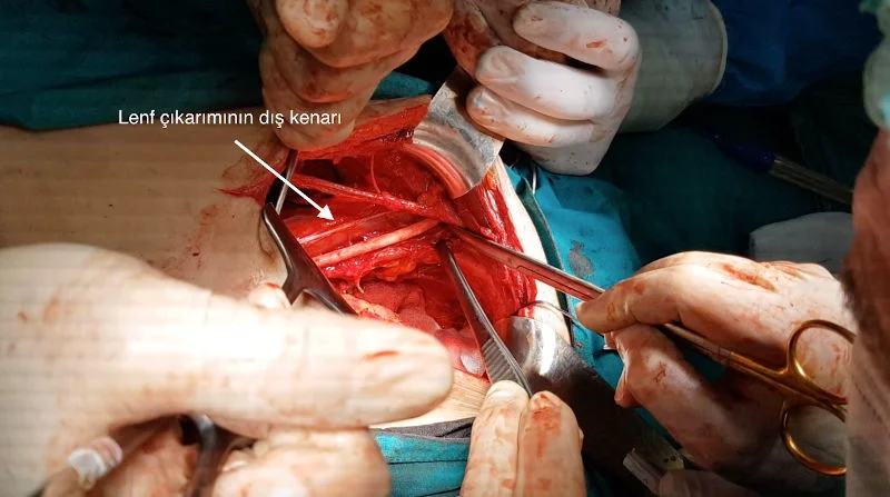 Önol Üroloji Önol Üroloji