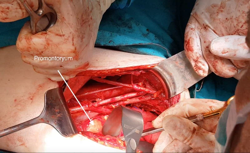 Önol Üroloji Önol Üroloji