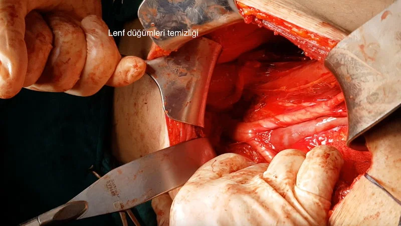 Önol Üroloji Önol Üroloji