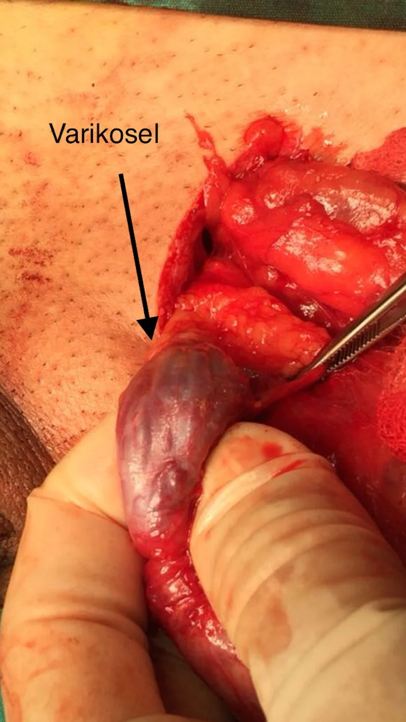 Demi Mur porno yulduzi